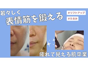 ミライ(Mirai)/たるみケア