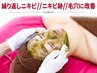 20代.30代繰り返しニキビ/毛穴/凸凹肌に徹底改善&ハーブピーリング＋毛穴洗浄