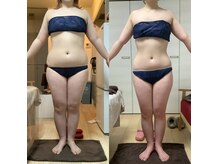 ナチュラル ボーテの雰囲気（痩身マシンで本気ダイエット！）