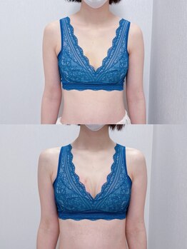 シアンビビ(Cyaan bibi)/プランプバスト