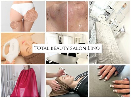 リノ(Lino)の写真