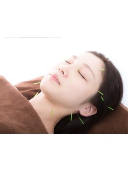 鍼灸施術を受けたい