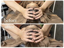 ビノスビューティー(vinos.beauty)/症例写真　小顔矯正