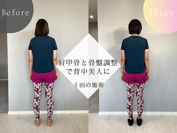 ウェルサス(WELLSUS)/5回のセッションで背中美人に