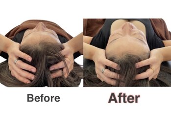 【医療提携】首肩こり・腰痛整体・マシンピラティスASABA整体院/我孫子店/ヘッドスパで睡眠改善