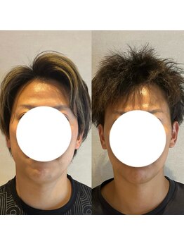 ラドンナ(LA DONNA)/韓国Oracle美容皮膚科提携機器