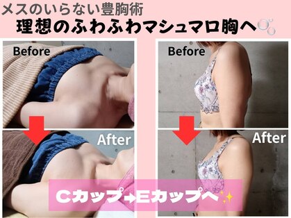 ミラクルバスト 松山店の写真