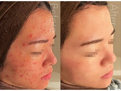 ベル 札幌(Belle)の写真