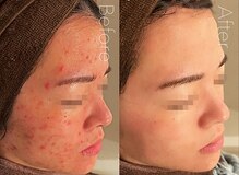 ベル 札幌(Belle)