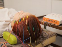 セットアップ鍼灸院(setup鍼灸院)/lift up美容鍼