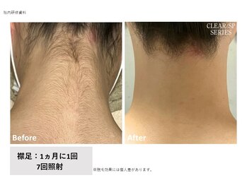 リレア(relair)/意外と見られています！うなじ！