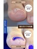 【巻き爪矯正】FOOT｜"巻き爪ケアジェル"単品(クリア仕上げ)※１本¥3300～