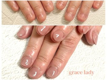 グレースレディ/スキンカラーは5色ご用意