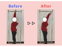 ストレッチヒーロー 広島中広店/首コリで悩まれている方必見！