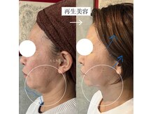 セレブリボーン 大阪ボーテの雰囲気（1番の老けポイント【横顔】周りは気付くが、本人は気付かず。）