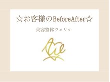 ウェリナ 一宮院/7.【ダイエットbefore→after】