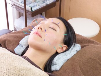 マナハ(MANAHA)の写真/【お顔の肌ツヤUP☆】美容鍼＋全身鍼灸ケア60分¥10000→¥8000顔も体も同時に◎美容効果/健康の両方叶える♪