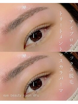 エフ(eFu)/◇施術イメージ◇