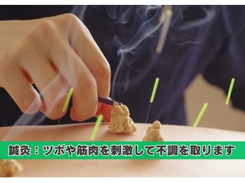 鍼灸マッサージ院 長津田駅前整骨院/鍼灸施術もお任せください