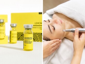 ベルフィーヌ ノーブル(BELLEFINE noble)の写真/お顔の脂肪を半永久的にケア♪【全顔レモンボトル打ち放題★￥6600】気になる顔の脂肪を解消！スッキリ小顔