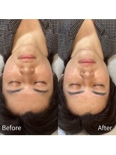 ビトタン 倉敷本店(+美to鍛)/左右差眉毛もお任せ！