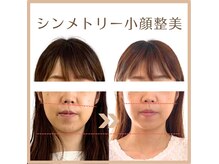 メラリノ(Melalino)の雰囲気（シンメトリー小顔整美♪）