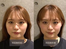 クイック美容整体 サロンエヌ(Quick 美容整体 salon N)/小顔矯正/骨盤矯正/整体/梅田