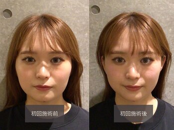 クイック美容整体 サロンエヌ(Quick 美容整体 salon N)/小顔矯正/骨盤矯正/整体/梅田