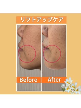 サロン ド ラン(Salon.du.RAN)/Befor After