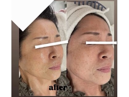 マカロン(Macaron)の写真