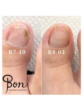ネイルアトリエ ボン(nail atelier bon)/フットネイルケア