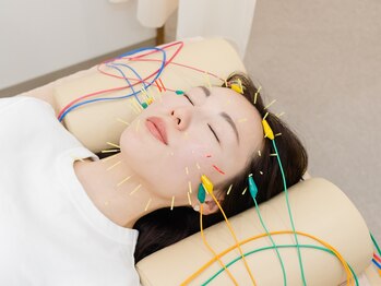 ピアーズ鍼灸整骨院の写真/美容鍼で顔に関係するツボに的確に刺激を与え、下がった筋肉を引き上げるからナチュラルにリフトアップ！