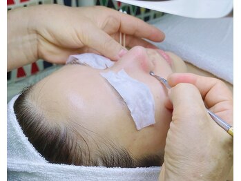 マインドテラピー 高田馬場/アクネケア！原因を徹底的に分析