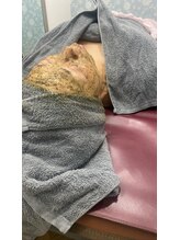 アトレ(Attre)/陶肌トリートメント