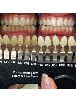 トウキョウスワーズ 池袋店(TOKYO SWRS)/#ホワイトニング #池袋 #渋谷