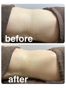 ギンザアール(GINZA R.)/ぽっこりお腹に集中アプローチ！