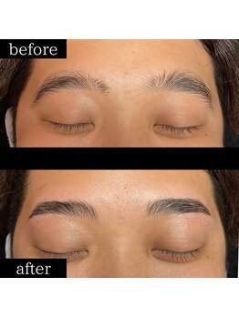 ユー 千葉駅前店(you)/症例写真