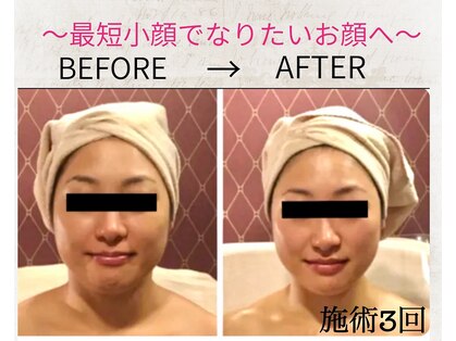 デアルーチェ(DEA LUCE)の写真