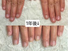 グラシナ なんば店/深爪/自爪育成/フィルイン