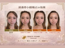 グレースフィオーレ 高槻店(gracefiore)の雰囲気（頭から整え自然な小顔へ導きます）