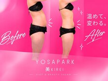 ヨサパーク 美キレイ 仙台店(YOSAPARK 美 Kirei)