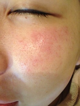 アイエステ(Ai esthe)/理想の肌に導く☆