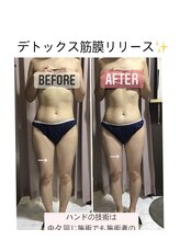 サザンベル 石垣店(SOUTHERN BELLE)/デトックス!!筋膜リリース☆