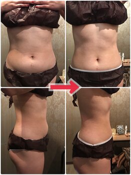 アンリアン 銀座店(Une Lien)/◆結果写真◆