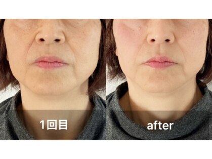 ツムギ(tsumugi)の写真