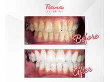ティアナ 豊橋店(Tiana)