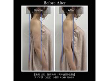 エキュレ ジャーニー トゥ マイ トータル ビューティー(equrer)/ブライダルケアにもおすすめ！