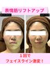 【高持続小顔★★★】たるみ・ほうれい線撃退＋背中マッサージ/RF◎贅沢180分