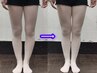 【骨盤矯正/歪み/Ｏ脚/太ももの張り】美容整体で真っすぐ綺麗な美脚に♪