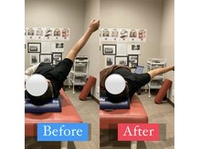 ナオル整体 宮崎院(NAORU整体)/50代男性施術事例【肩痛改善】